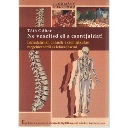 Ne veszítsd el a csontjaidat!