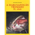 A harcsafogás trükkjei II.rész